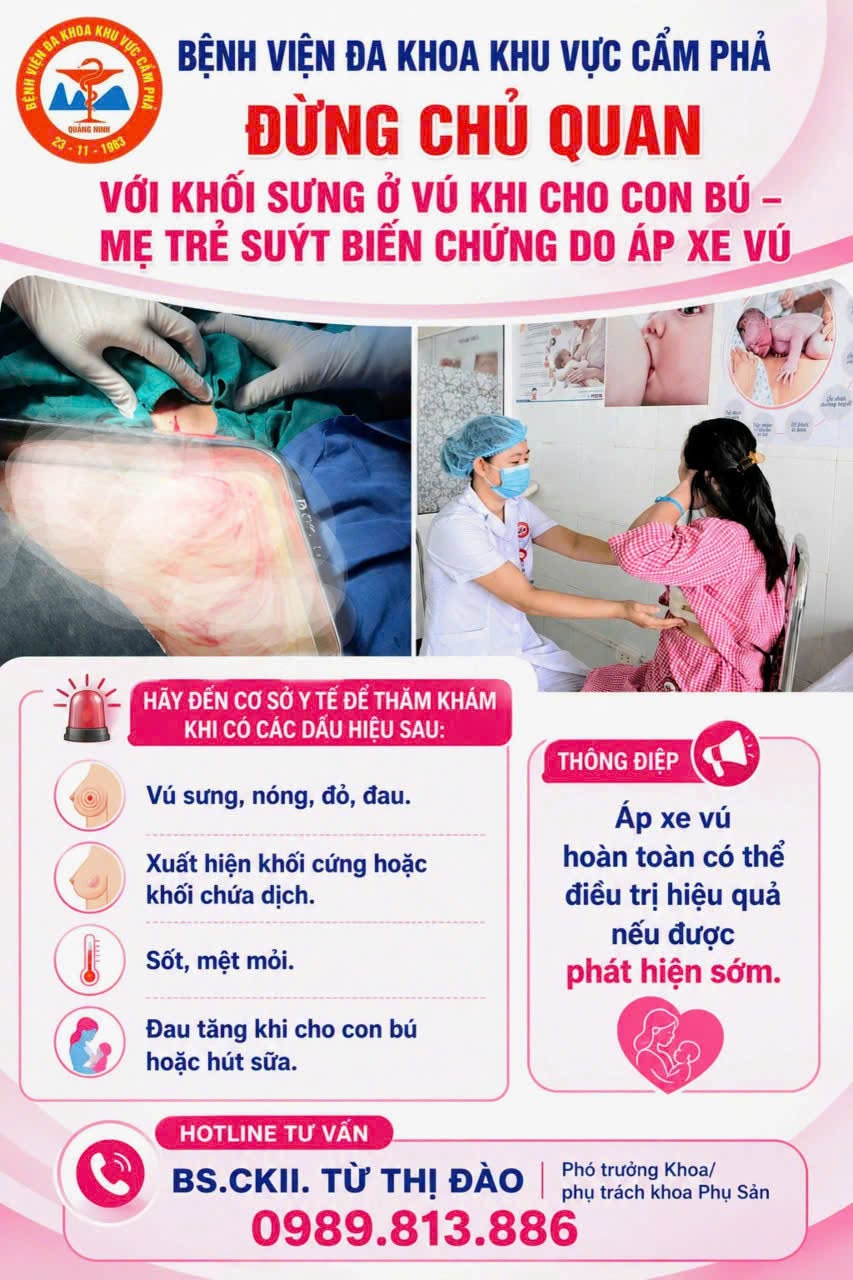 ĐỪNG CHỦ QUAN VỚI KHỐI SƯNG Ở VÚ KHI CHO CON BÚ – MẸ TRẺ SUÝT BIẾN CHỨNG DO ÁP XE VÚ